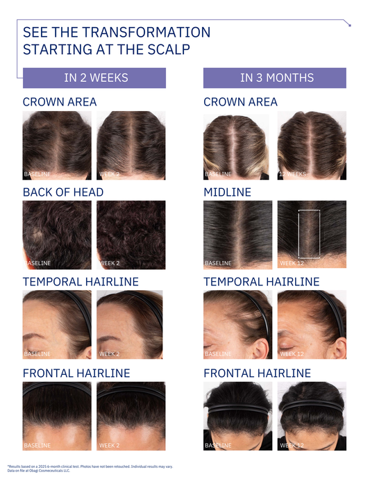 OBAGI NU-CIL® BIOSTIM™ SCALP SERUM